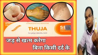 Thuja Ointment  Uses  Dosage  SideEffects full detail [upl. by Ashley]