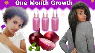 Onion Juice For Hair Growth 😱BEFORE AND AFTER RESULTS [upl. by Mickey]