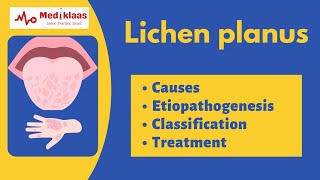 Lichen planus l Causes symptoms treatment l Oral pathology l Mediklaas [upl. by Nwahsd]