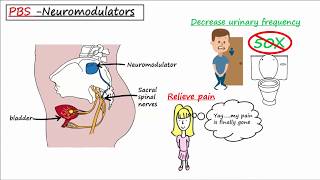 Probiotics Biofilms and Interstitial Cystitis Dr Tim Hlavinka on UTIs Part 2 [upl. by Edelsten34]