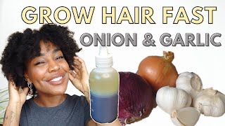 ONION AND GARLIC hair oil for RAPID hair growth and REDUCE HAIR FALL [upl. by Aural]