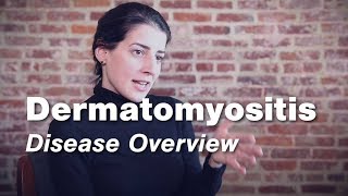 Dermatomyositis  Disease Overview  Johns Hopkins [upl. by Leahcimrej200]