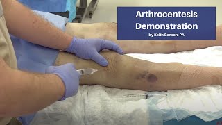 Arthrocentesis Demonstration  The CadaverBased EM Procedures SelfStudy Course [upl. by Sudhir]