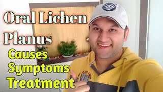 Oral Lichen Planus Symptoms Causes Types amp Treatment [upl. by Adlai931]