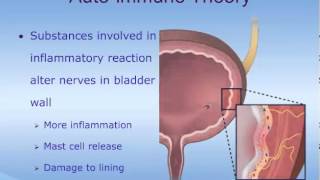 Understanding Interstitial Cystitis IC [upl. by Wettam]