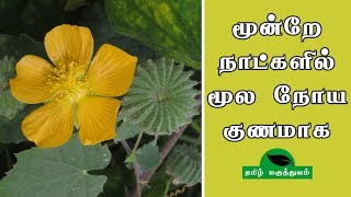 மூன்றே நாட்களில் மூல நோய் குணமாக  Thuthi ilai uses in Tamil  Abutilon Indicum for Piles [upl. by Temple]