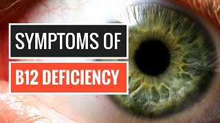 5 Signs and Symptoms of Vitamin B12 Deficiency [upl. by Julissa]