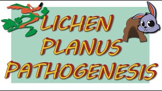 LICHEN PLANUS  Etiology amp pathogenesis [upl. by Glinys]