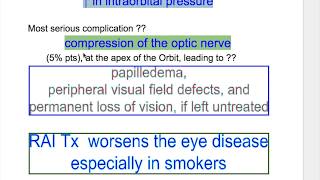 Exophthalmos Thyroid Ophthalmopathy [upl. by Moscow]