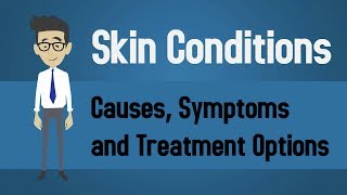 Skin Conditions  Causes Symptoms and Treatment Options [upl. by Jorry4]