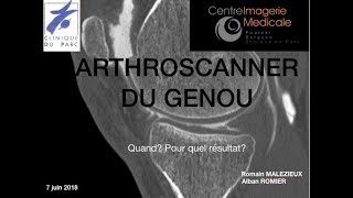 Arthroscanner du genou Alban ROMIER [upl. by Leirum436]